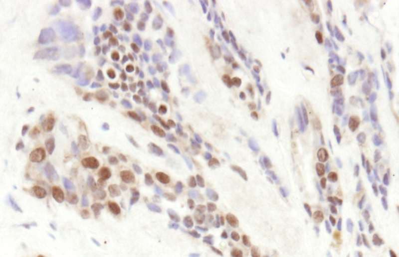 TBL1XR1 / TBLR1 Antibody (aa100-150)