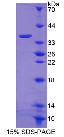Rat ALOX15B / 15-LOX-2 Protein (Recombinant His-T7)