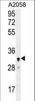 UBXD4 / UBXN2A Antibody (aa166-195)