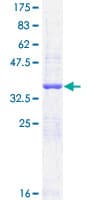 Human NPRB / NPR2 Protein (Recombinant GST, N-terminus)