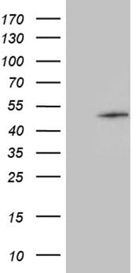 Monoclonal Mouse anti-Human GABPB1 Antibody (clone OTI3F1, aa128-360, WB)
