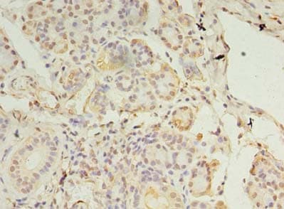 CCDC109B Antibody