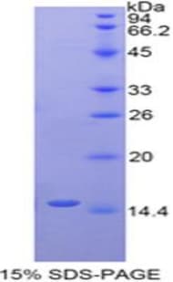 Human LYAR Protein (Recombinant His-T7)