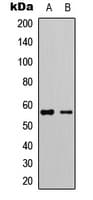 p56lck / LCK Antibody (phospho-Tyr505)