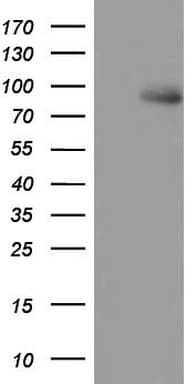 MDM2 Antibody (aa119-438, clone OTI4E5)