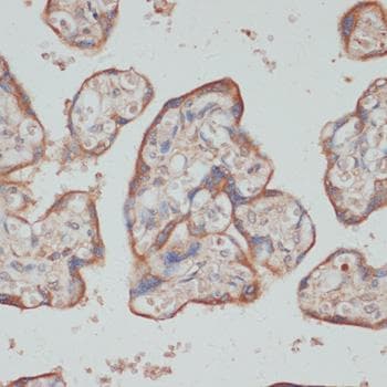 Polyclonal Rabbit anti-Human TES / Testin Antibody (IHC)