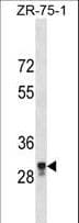 MPPED2 Antibody (aa224-251)
