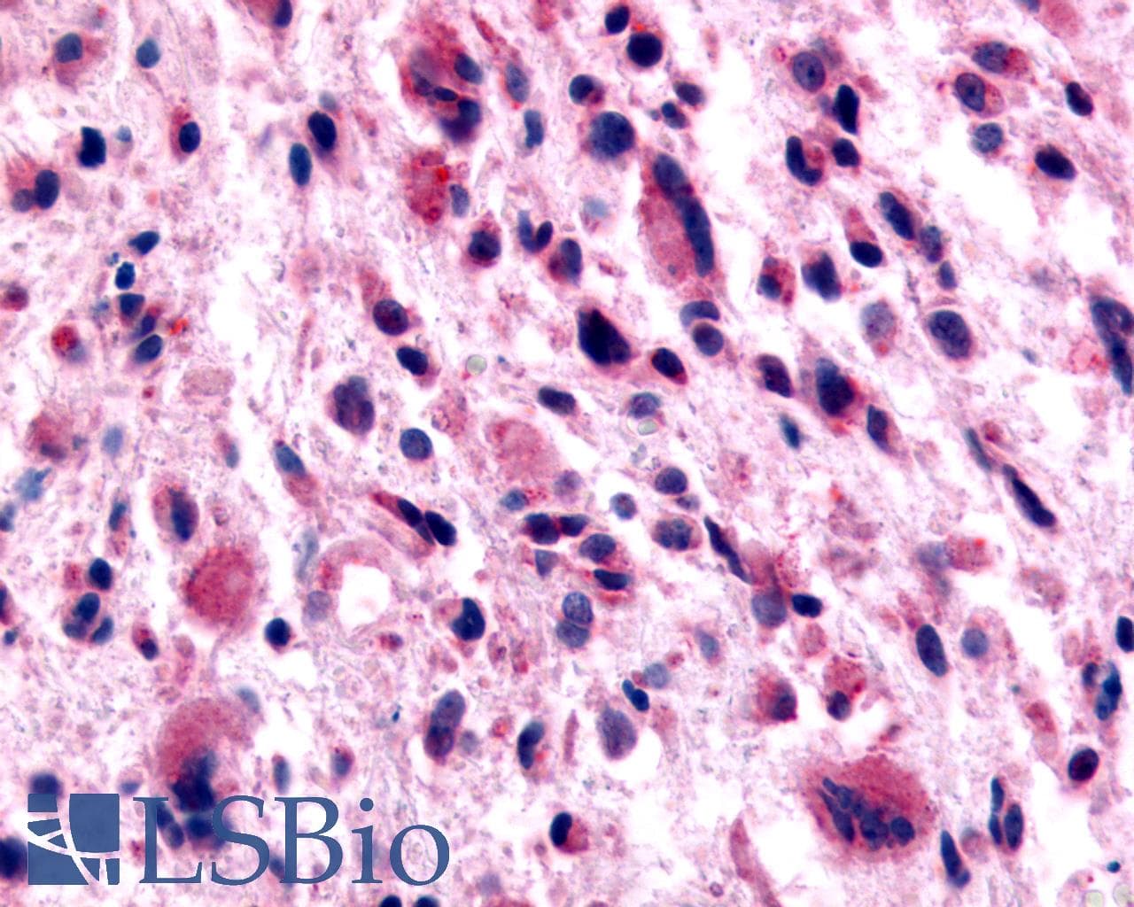 PathPlus™ Polyclonal Rabbit anti-Human GABBR1 / GABA B Receptor 1 Antibody (N-Terminus, IHC)