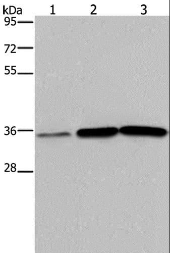 MAGEA3 Antibody