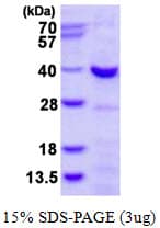 Human CHMP4A Protein (Recombinant His)