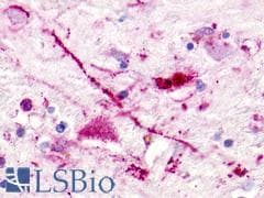 PathPlus™ TAAR5 Antibody (Extracellular Domain)