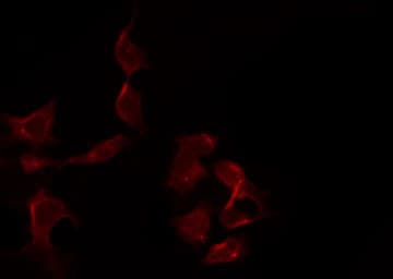 RRS1 Antibody
