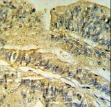 FKBP2 Antibody (aa11-41)