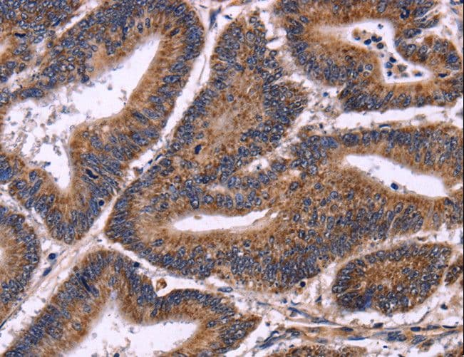 AMIGO2 Antibody