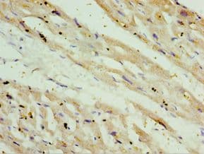 OXCT1 Antibody (aa261-520)