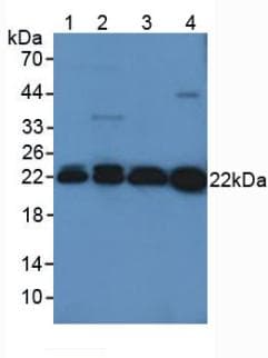 PRDX2 / Peroxiredoxin 2 Antibody (aa6-164, PE)