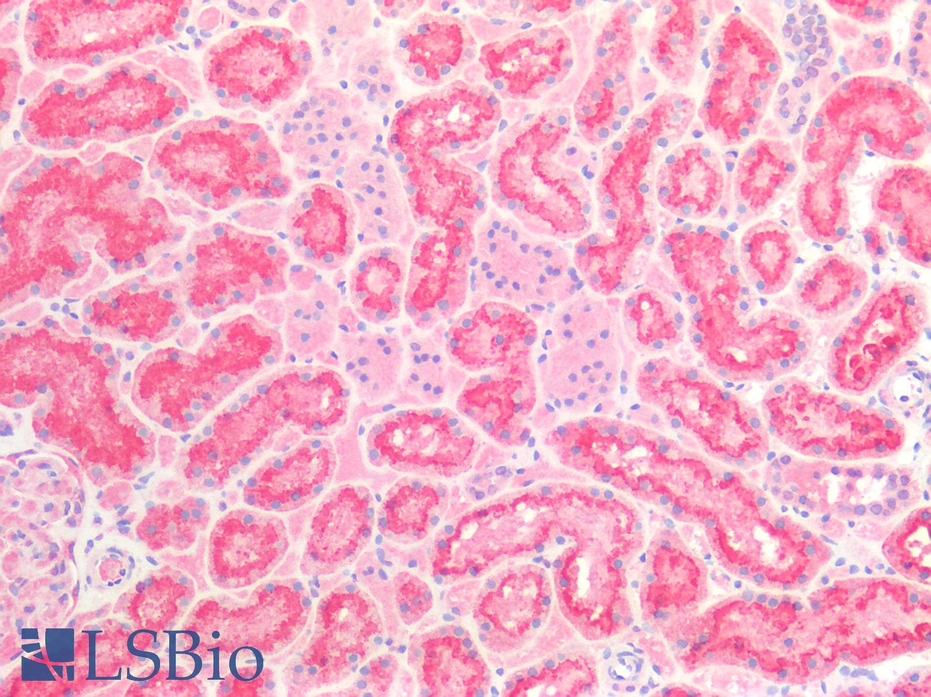 IHC-plus™ HPRT1 / HPRT Antibody (clone AT1D9)