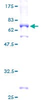 Human TRB3 / TRIB3 Protein (Recombinant GST)