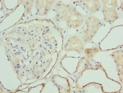 Polyclonal Rabbit anti-Human ZNF563 Antibody (IHC, WB)