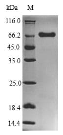 Porphyromonas gingivalis rgpA / Gingipain R1 Protein (Recombinant 6His-B2M, N-terminus)
