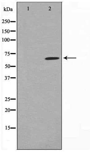 MMP14 Antibody