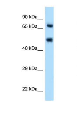 Polyclonal Rabbit anti-Human SELE / CD62E / E-selectin Antibody (aa81-130, WB)