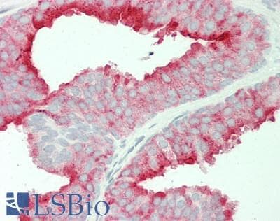 PathPlus™ FOLH1 / PSMA Antibody (clone 5C4)