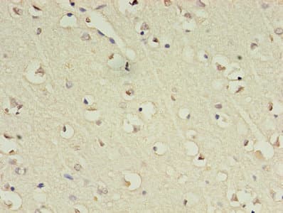 GABRA4 Antibody (aa36-258)