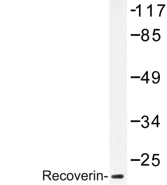 Recoverin Antibody (Asp143)