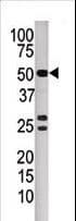 Polyclonal Rabbit anti-Human PPP3CB Antibody (aa1-30, IHC, WB)