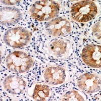 Polyclonal Rabbit anti-Human PDGF-CC Antibody (IHC, WB)
