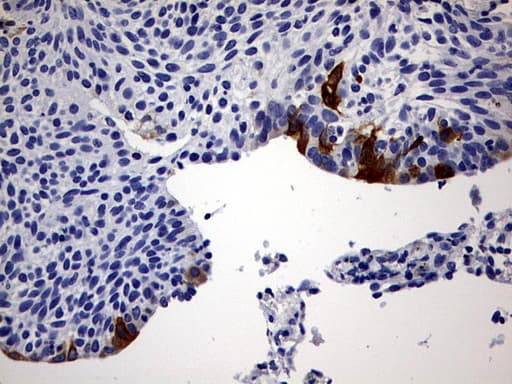 RBFOX1 / A2BP1 Antibody (aa1-210, clone OTI1F7)