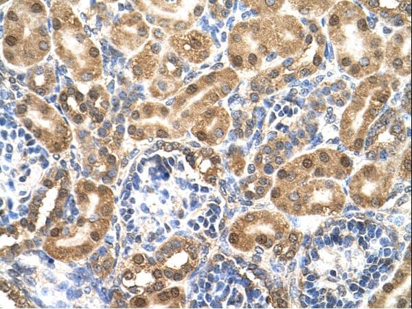 ENO3 / Enolase 3 Antibody (N-Terminus)