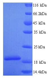 Human PLA2G12A Protein (Recombinant 6His, N-terminus)