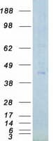 Human PHKG1 Protein (Recombinant Myc-DDK (Flag))