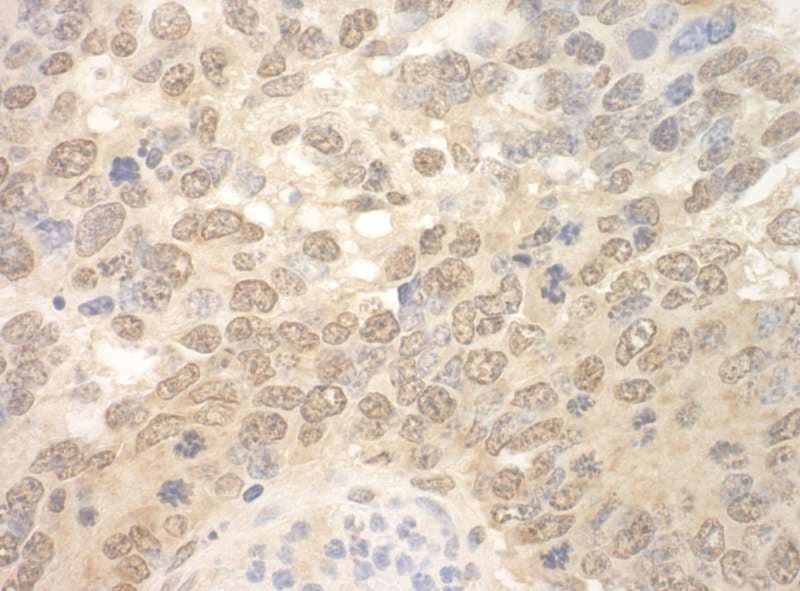 RBM17 Antibody (aa25-75)