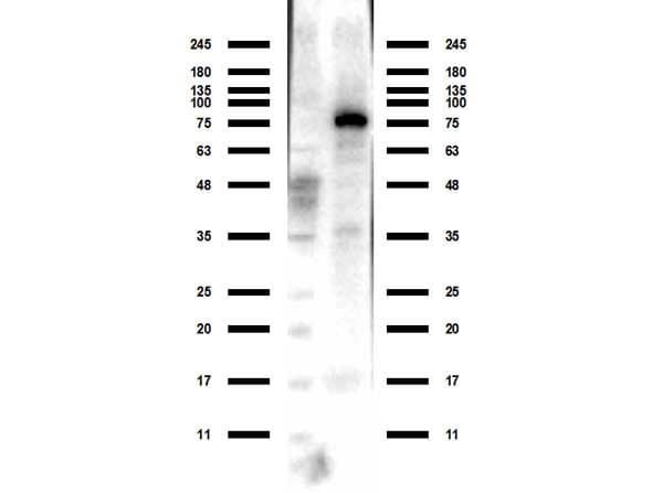 Polyclonal Rabbit anti-Human ACSS2 / ACAS2 Antibody (N-Terminus, WB)