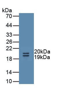 UMOD / Uromodulin Antibody (aa30-150)