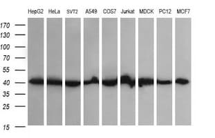 ACAA2 Antibody (clone OTI2H2)
