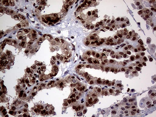 MGMT Antibody (clone OTI6G6)