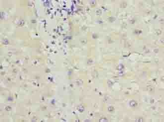 IHC-plus™ PPP1R3B Antibody