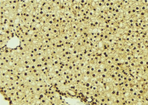 Polyclonal Rabbit anti-Human PDPK1 / PDK1 Antibody (IHC, WB)