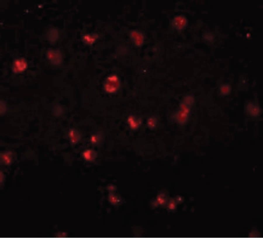 IHC-plus™ Polyclonal Rabbit anti-Human NOD3 / NLRC3 Antibody (IHC, IF, WB)