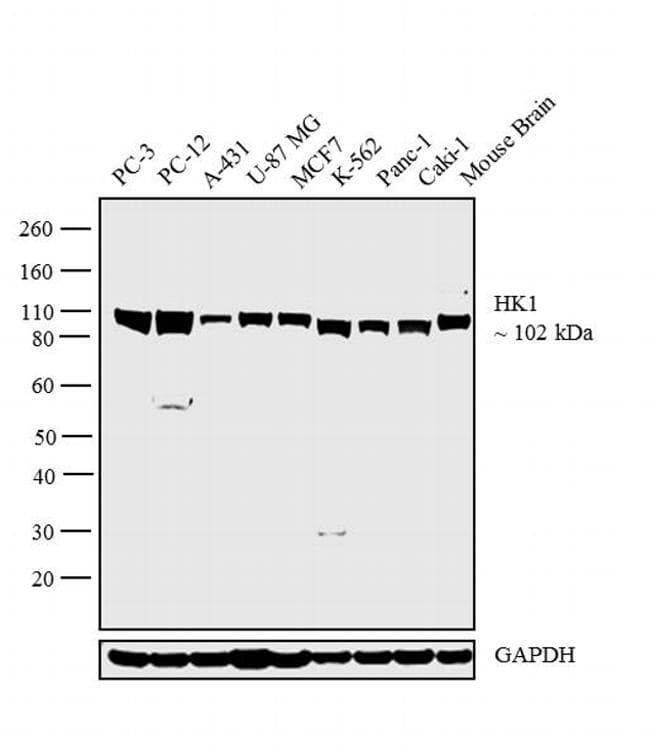 HK1 / Hexokinase 1 Antibody (clone 3A10)
