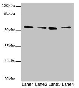 Polyclonal Rabbit anti-Human ERO1LB Antibody (IHC, WB)