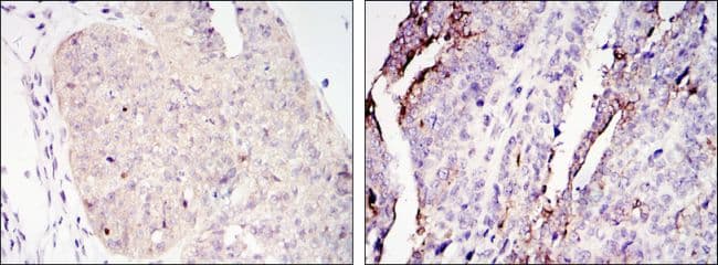 CRTC2 / TORC2 Antibody (clone 5B10)