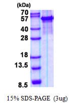 Human ARSG / Arylsulfatase G Protein (Recombinant His)