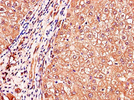 IGHMBP2 Antibody