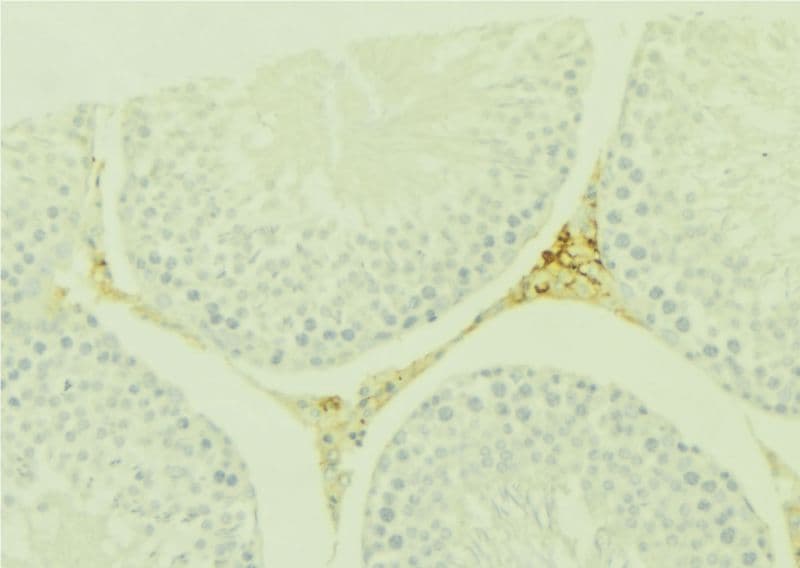 Polyclonal Rabbit anti-Human WNT7A Antibody (IHC, WB)