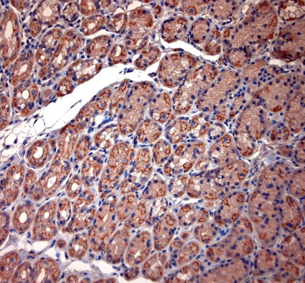 TPC2 / TPCN2 Antibody (aa700-752)